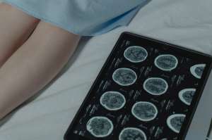 Steps to take after TBI Steps to take after TBI